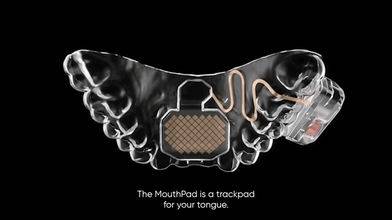 MouthPad
