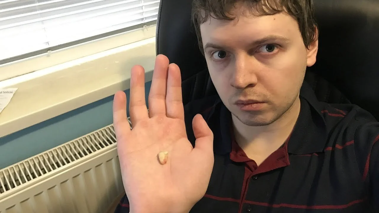 Фанаты продолжают донимать Папича — один из них засунул батончики Nuts в его щиток
