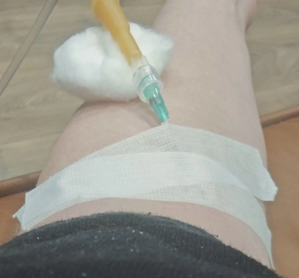 Хованский с капельницей в руке