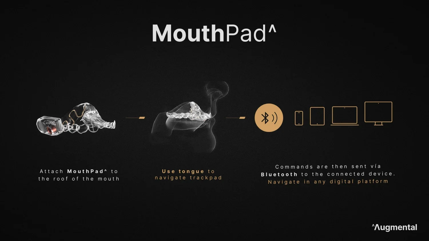 MouthPad